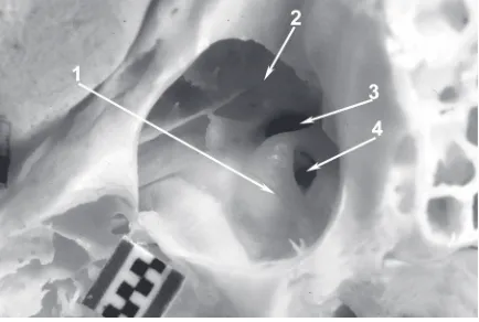 Figure 6. Macaque’s left tympanic cavity interior with auditoryossicles inside. Widened external acoustic meatus
