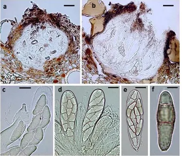 Fig. 42 Farasanispora avicenniae (holotype) a, b Vertical section of ascomata c Ascus 