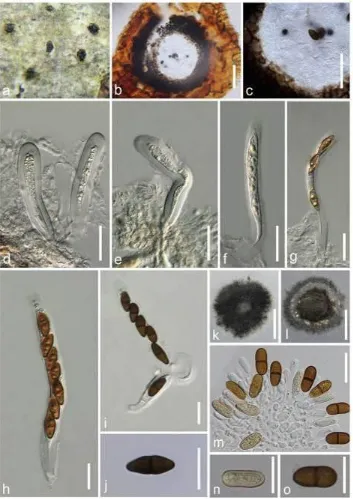 Fig. 4 Dothiorella vidmadera (MFLU 15–3483, reference specimen) a Appearance of 