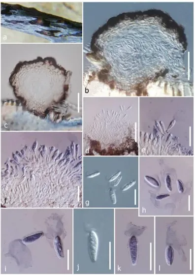Fig. 6 Mucoharknessia anthoxanthi (holotype) a Appearance of conidiomata on host surface b, c Sections through conidiomata d–f Immature conidia attached to conidiogenous cells g Conidia with mucoid appendage h–l Conidia with mucoid appendage stained in Ind
