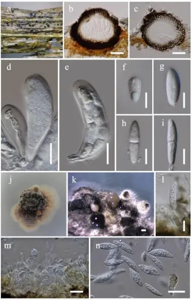 Fig. 8 Neophaeocryptopus cytisi (holotype) a Appearance of ascostromata on host substrate b, c Sections of the ascostromata d, e Asci f–i Ascospores j, k Conidiomata produced on PDA l, m, n Mature and immature conidia attached to conidiogenous cells g Matu