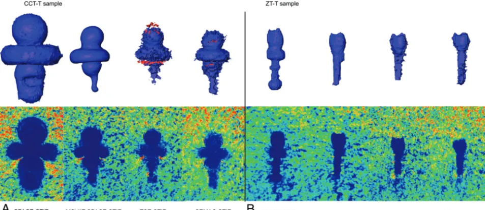 FIG 1. Artifact volumes (signal loss and pileup artifacts) of all sequences caused by the CCT-T (A) and the Z-T (B) samples (double asterisksindicate P � .001; numbers next to the bars indicate the volume of pileup and signal loss artifacts separately in m