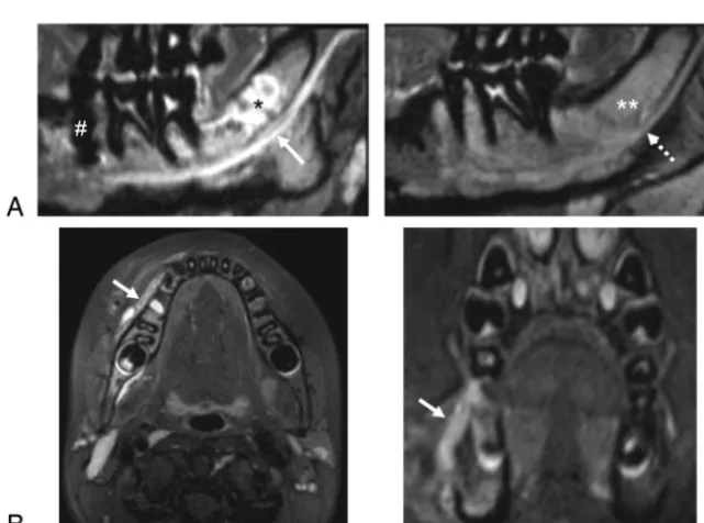 FIG 5. Mean visibility scores of in vitro images of the 8 anatomic structures in all STIR sequences