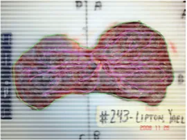 Figure 3. Image of placenta ID#243 from the NYU data set. 