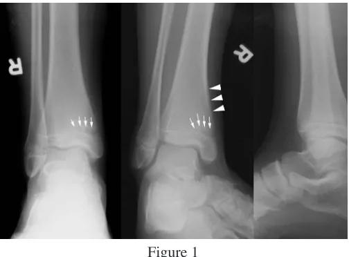 Figure 1 Figure 2 