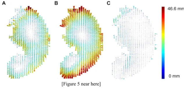 Figure  5:  Vector  maps  for  ‘anatomical  bias’,  VLBM  misplacement,  and  corrected VLBM misplacement 