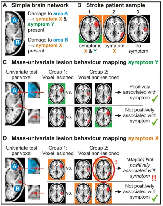 Illustration  of  the  ‘partial  injury  problem’  in  mass-univariate  lesion  behaviour  mapping