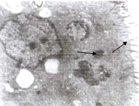 Figure 14. Ileac villus ultrastructure in control group at 42 days of age (TEM × 10,000)