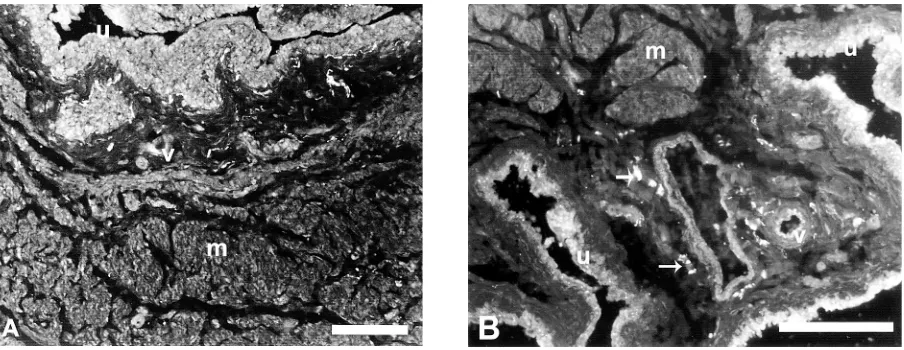 Figure 1. Young (A) and aged (B) rat urinary bladder base immunostained with VR1. Both age groups showed positive immunoreactivityto VR1