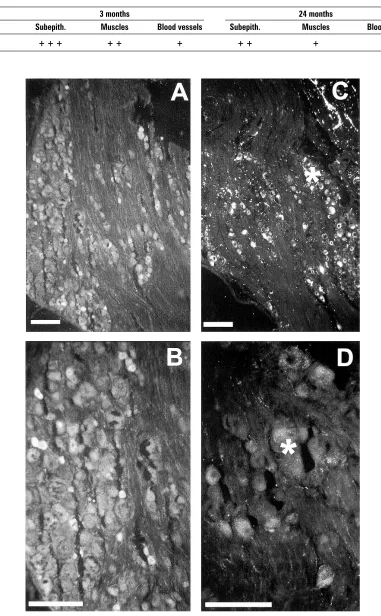 Table 1. Semi-quantitative estimation of VR1-ir nerve densities in the urinary bladder base in young (3-month-old) and old(24-month-old) rats; +: sparse; + +: moderate; + + +: dense