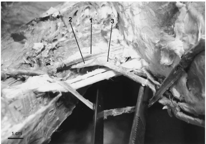 Figure 4. The course of the short saphenous vein on the posterolateral surface of the calf of the left hind leg of the baboon