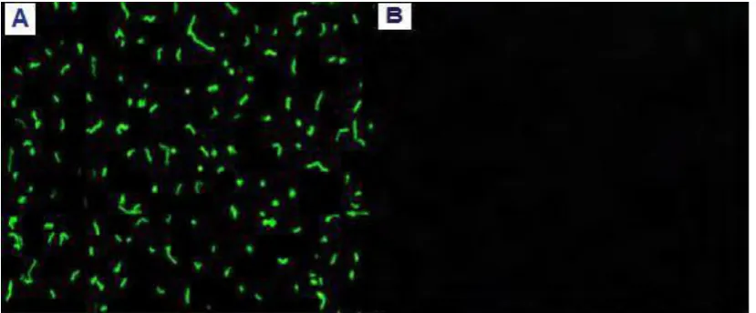 Figure 1: IIF staining of H. pylori IgG (40X) showing: A: Seropositive of anti- H. pylori IgG in sera of CAD patients