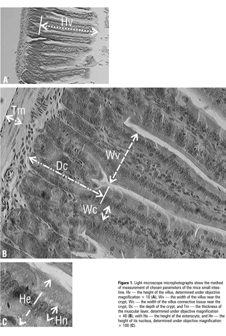 Figure 1. Light microscope microphotographs show the methodof measurement of chosen parameters of the mice small intes-tine