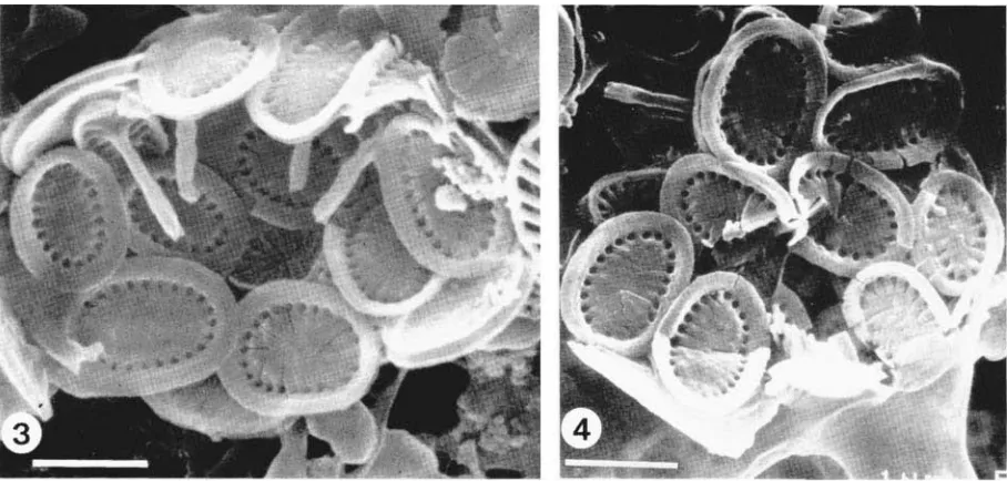 Fig. 1: Disintegrated coccosphere of Syracosphaera marginaporata sp. nov. Coccoliths are oval caneoliths with pores at the margin of the central area