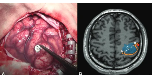 FIG 1. The mathematic model used to quantify the anatomic characteristics (the original magni-ﬁcation of the smaller pictures was �200%)