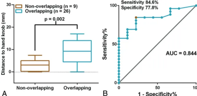 FIG 6. The relationship between D-min and the nonoverlapping phenomena of BOLD fMRI and acomparison with DCS results
