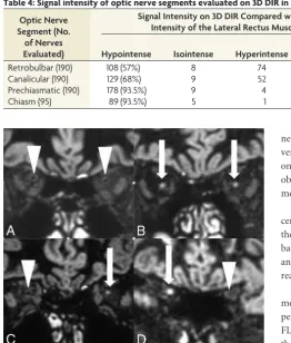 Table 4: Signal intensity of optic nerve segments evaluated on 3D DIR in patients with MS