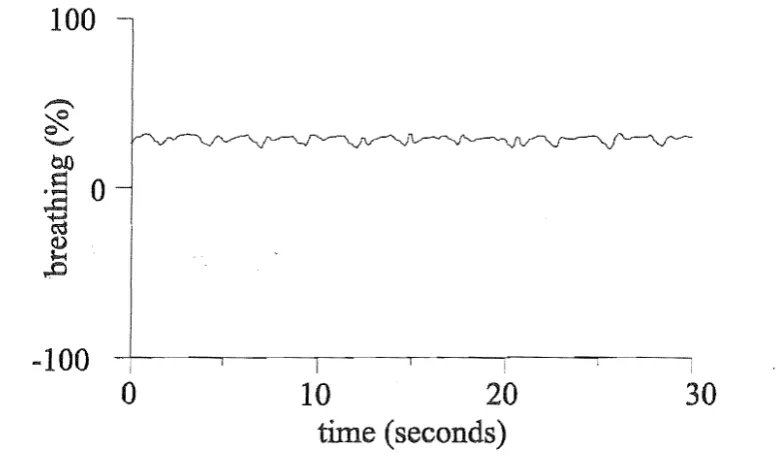 Figure 2.10 is Low amplitude signal representing normal, regular breathing. Note how the signal flattened during much of each oscillation, compared to a normal breathing signal as in Figure 2.8