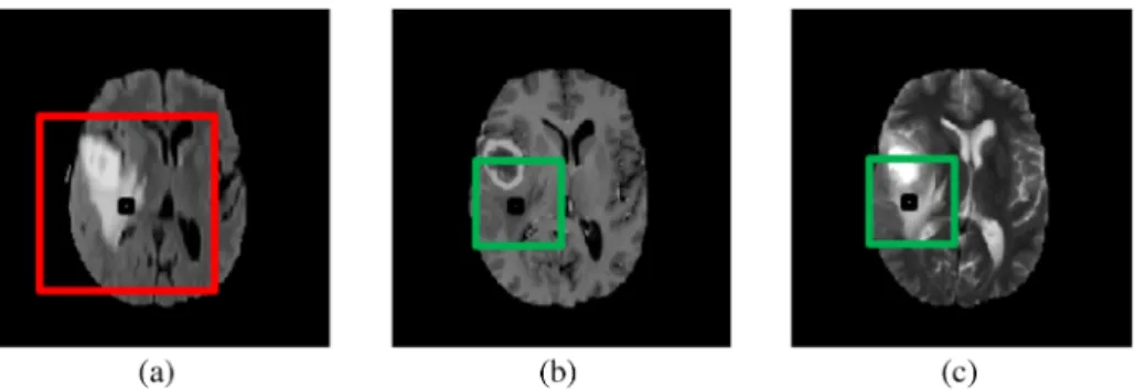 Fig. 2 (a) Flair model with patch size 64 ×64, (b) and (c) T1ce and T2 modalities with patch size 32×32, respectively