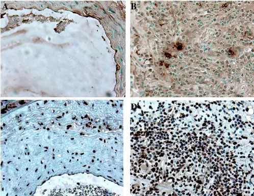 Figure 7Investigation of apoptosis and proliferation in the pathogenesis of MCMV induced neointima formation