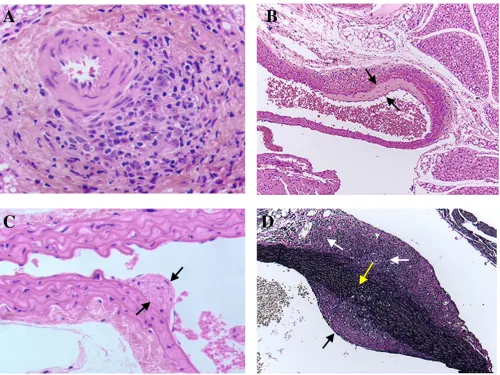 Figure 1Beginning of arterial wall thickening induced by infecting IFN-γR-/- mice with MCMV