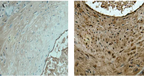 Figure 3Immunohistochemistry of neointima.  A. Negative control for α-SMA staining (primary antibody omitted)