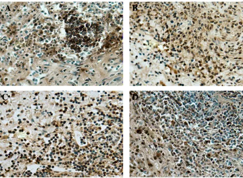 Figure 4Characterization of inflammatory infiltrate. Aortas collected from MCMV infected IFN-γR-/- mice 4 months after infec-tion and 2 months after whole body irradiation