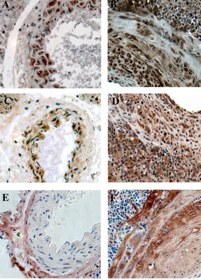 Figure 5Investigation of the role of growth factors in the pathogenesis of MCMV induced neointima formation.specific for TGF-  A,C,Eabdominal aortas collected from control uninfected IFN-γR-/- mice 2 months after whole body irradiation
