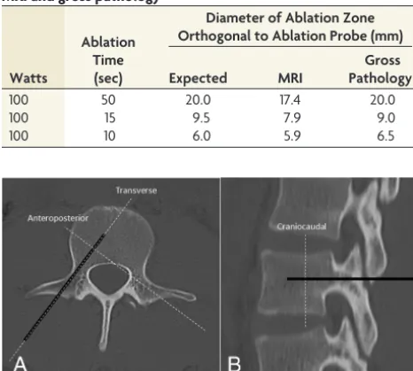 Table 3: Technical parameters used for microwave ablation,expected minor-axis diameter of the ablation zones based onnonanimal models, and measured ablation zone diameters onMRI and gross pathology