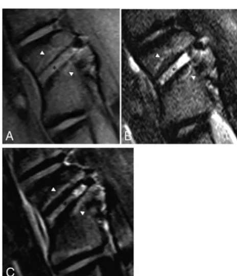 Table 5: MRI, gross, and histopathologic ﬁndings produced by all 3 ablation modalities