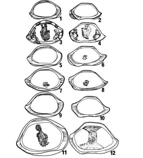 Fig. 7. Purunesideu ulgicolu Maddocks, 1969. 1, RT/SIR/67 LV, int. lat. ( X  52); 2, RT/SIR/66 RV, int