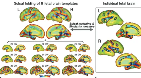 FIG 1. Processing overview for the identiﬁcation of sulcal basins on the cortical plate surface