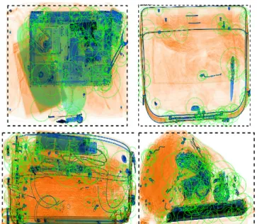 Figure 2. SURF feature points (green) give a raw indication of composition complexity across the X-ray image.