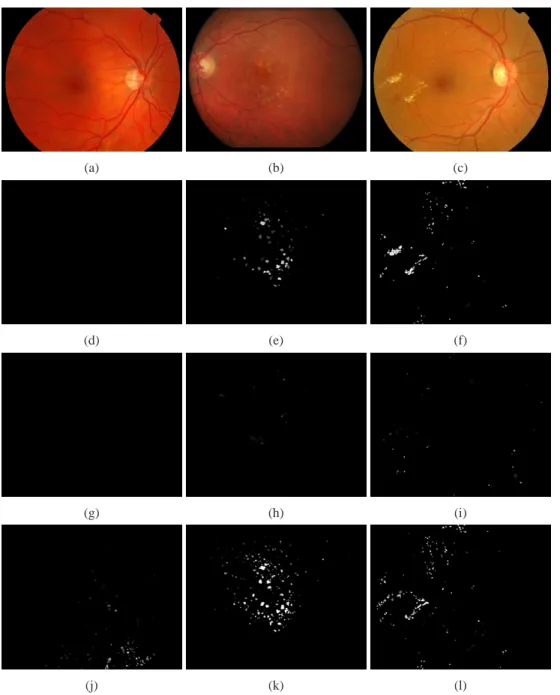 Fig. 2. Examples of images with the outputs of the individual automatic lesion detection systems