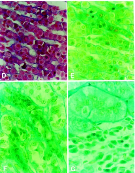 Figure 1.  Adrenal cortex cross-section after staining acc. To Masson’s method (D) and Masson/GIF (green filter)