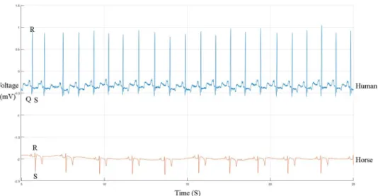 Figure 1.  Humane (upper) and equine (lower) ECG at rest. Both ECGs are shown at the same paper speed and  resolution