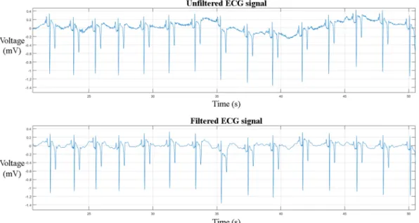 Table 1.  Comparison of proposed QRS detection algorithm with Pan-Tompkins 32  on 10356 equine QRS  complexes.