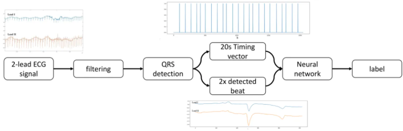 Figure 3.  High level architecture of the complete proposed ECG processing method. Two raw ECG leads  are filtered and QRS detection is performed on lead II