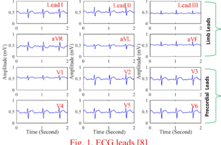 Fig. 1. ECG leads [8]  