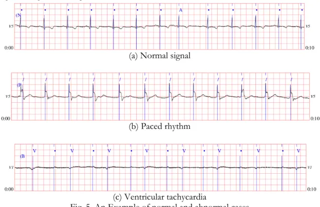 Fig. 5. An Example of normal and abnormal cases