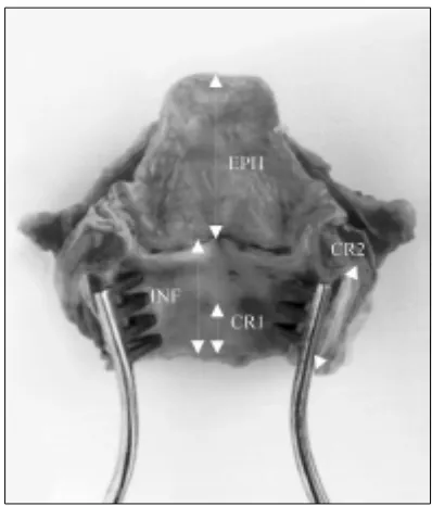 Figure. 1. Diameters describing thyroid cartilage and epiglottis,lateral view.