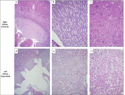 Fig. 5a. Examples of pathologic changes in the operated as opposed to control kidneys: D: hydronephrosis and prominent dilatation of non-proximal tubules with; E and F: relative reactive thinning of the lining cuboidal epithelium; A and D: hematoxylin & eo