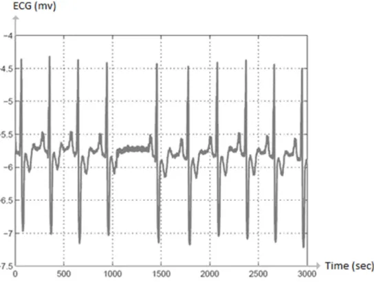 Figure 4. Example of collective anomaly, 1000-1500 secs. 