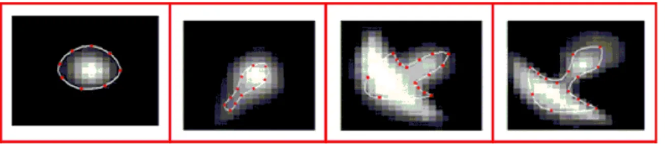 Figure 4. Encoding nodule shapes by landmarks. Taken from [30].