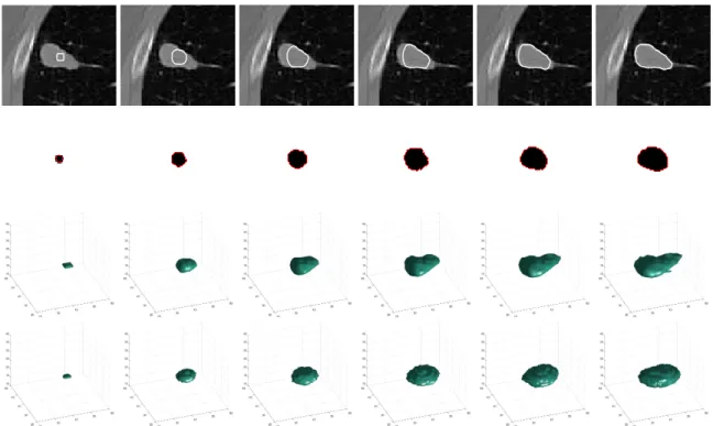 Figure 9. Surface and adaptive shape prior evolution. First column corresponds to the initialization