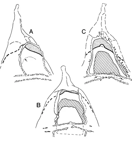 Fig. 2. Archaeopyle and opercular style in Conyaufacysta jurussica ( x 1250); only the parasutural crests in the vicinity of the archaeopyle are shown