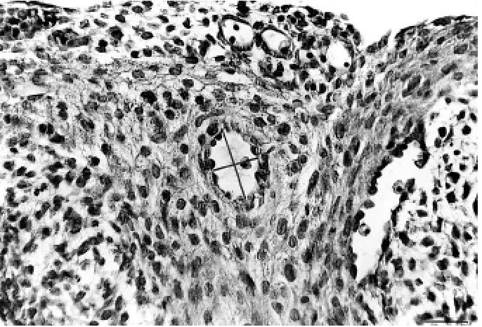 Figure 1. Hmen diameter. Bar = 50 cross section. The short and the long lines represent the lumen dimensions; the short line from each measurement has been taken as lu-&E stained section of ED15.5 heart