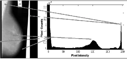 Figure 1: Different Mammographic images  