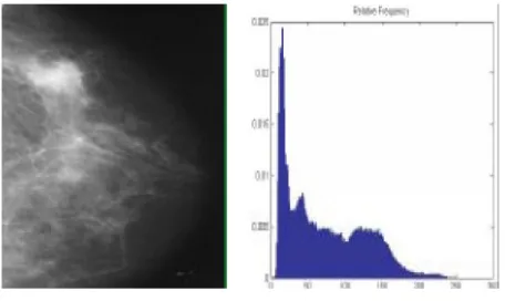 Figure 4: Cropped Mammogram and its gray level histogram 