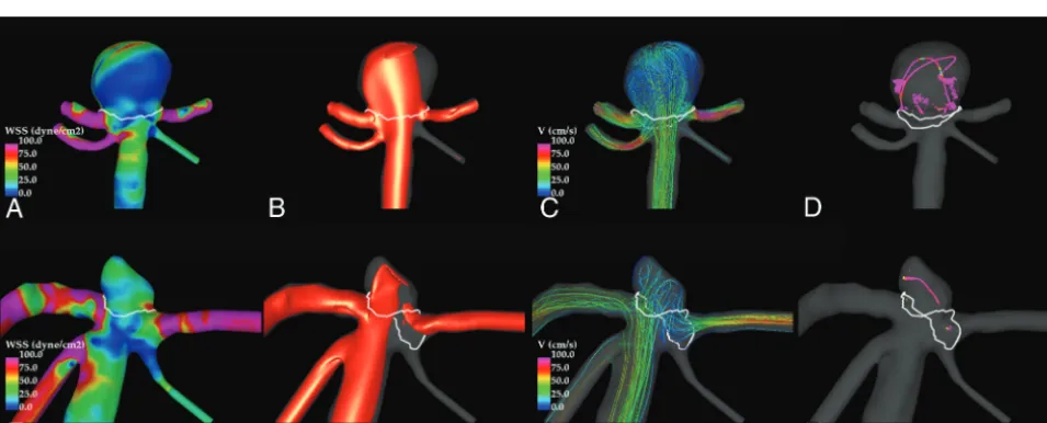 FIG 3.Comparison of hemodynamic variables across BAtip and ICAbif aneurysms groupedaccording to their sizes as small, medium, and large